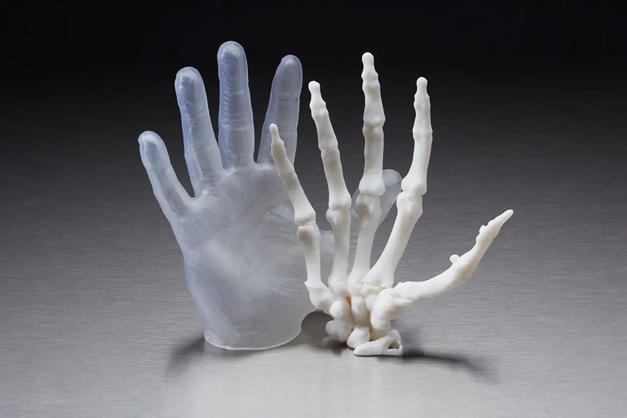 3D printer anatomical model of a hand